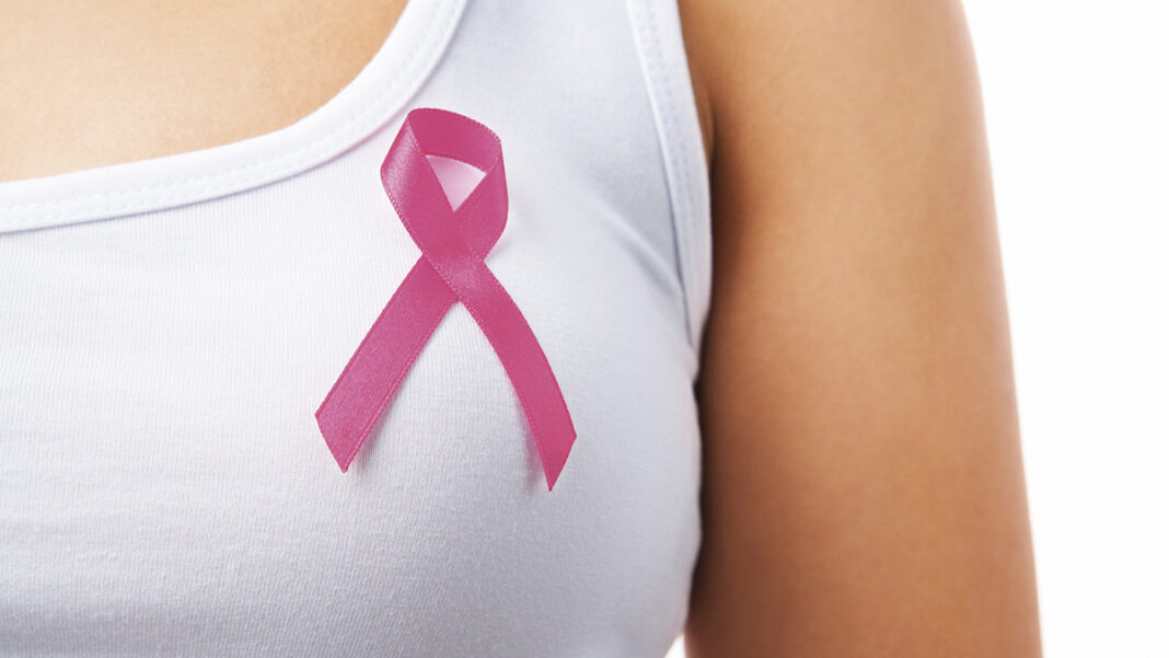 Fisioterapia y cancer de mama